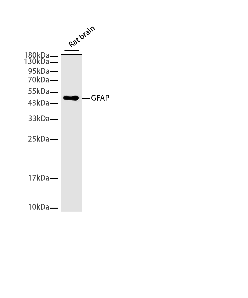 Rabbit monoclonal antibody