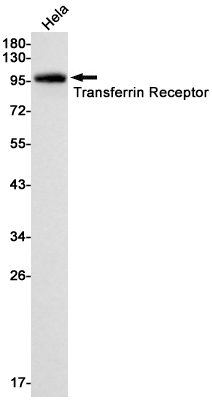 Rabbit monoclonal antibody