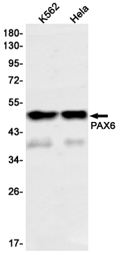Rabbit monoclonal antibody