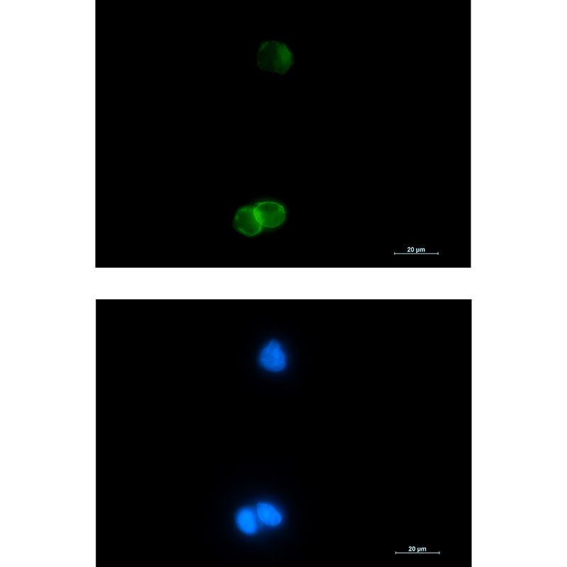 Rabbit monoclonal antibody