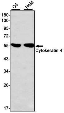 Rabbit monoclonal antibody