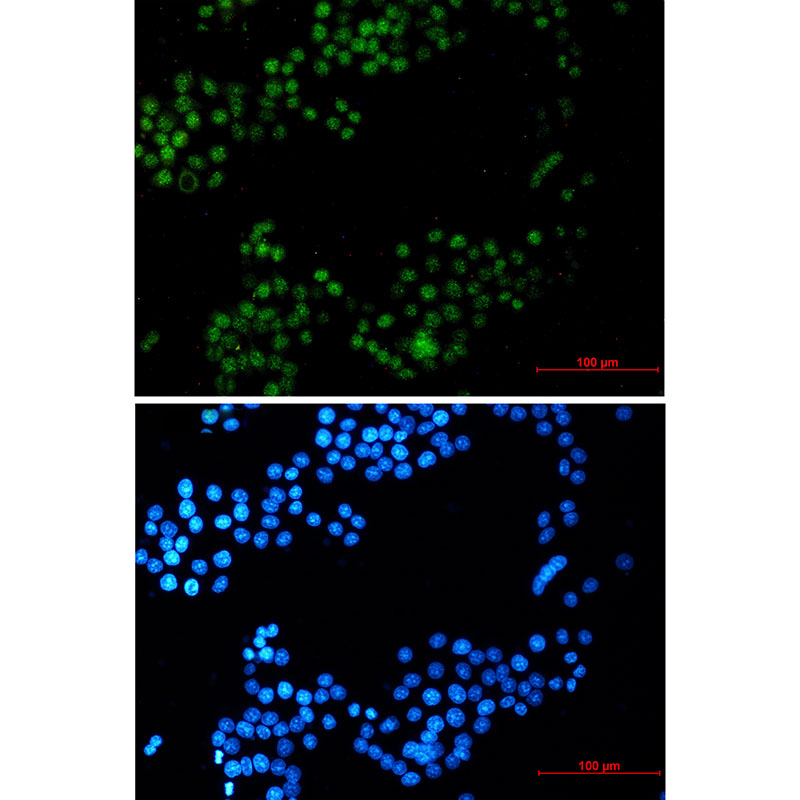 Rabbit monoclonal antibody