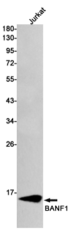Rabbit monoclonal antibody