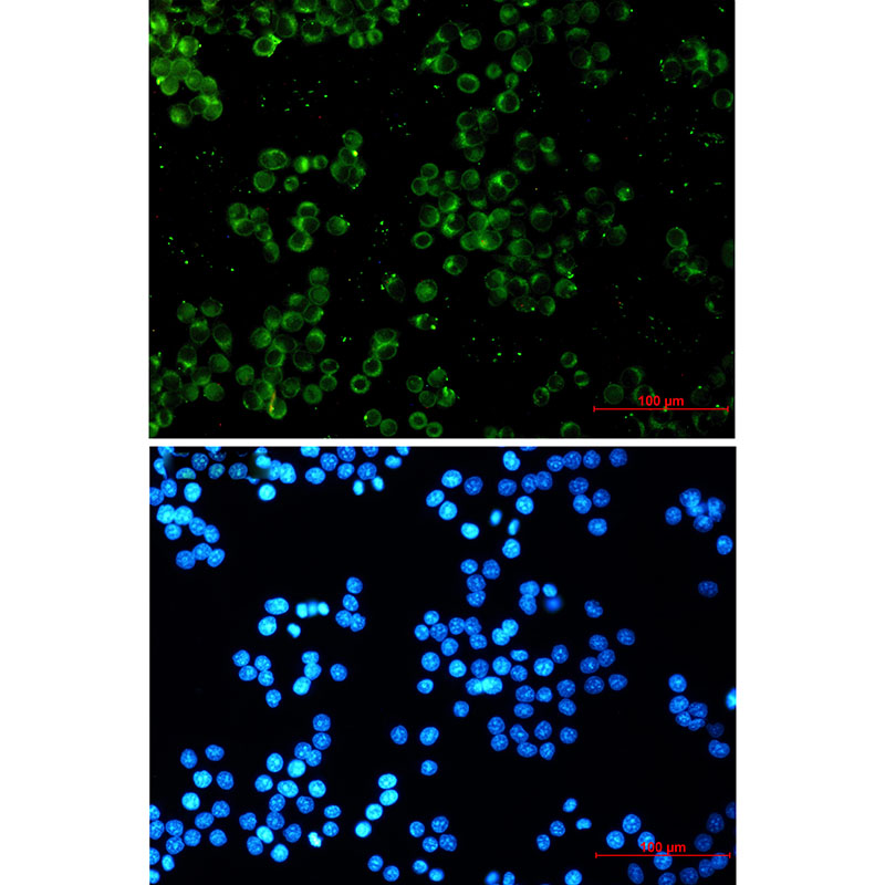 Rabbit monoclonal antibody