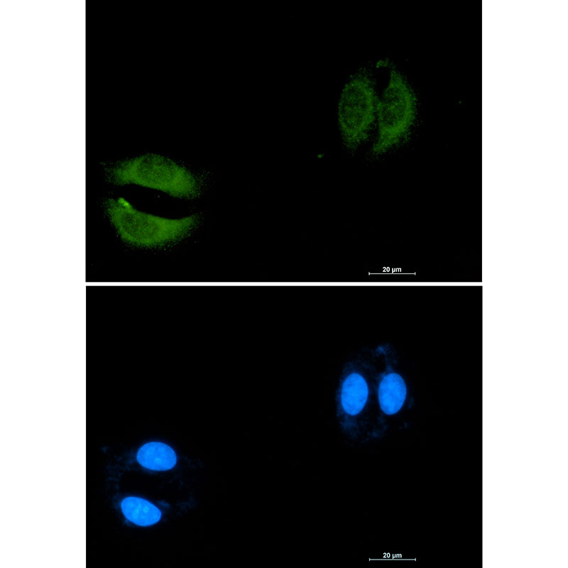 Rabbit monoclonal antibody