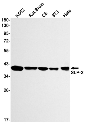 Rabbit monoclonal antibody