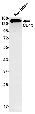 Rabbit monoclonal antibody