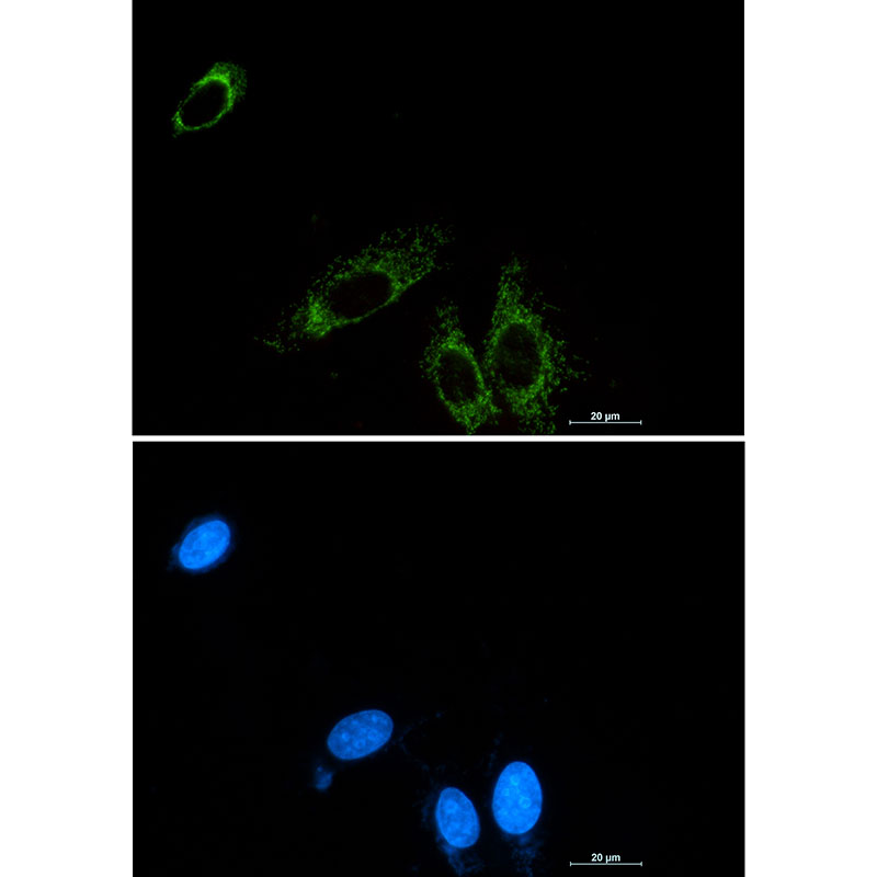 Rabbit monoclonal antibody