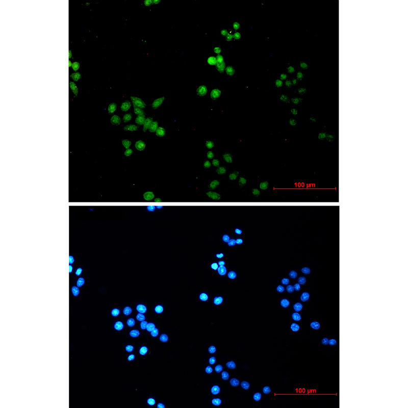 Rabbit monoclonal antibody