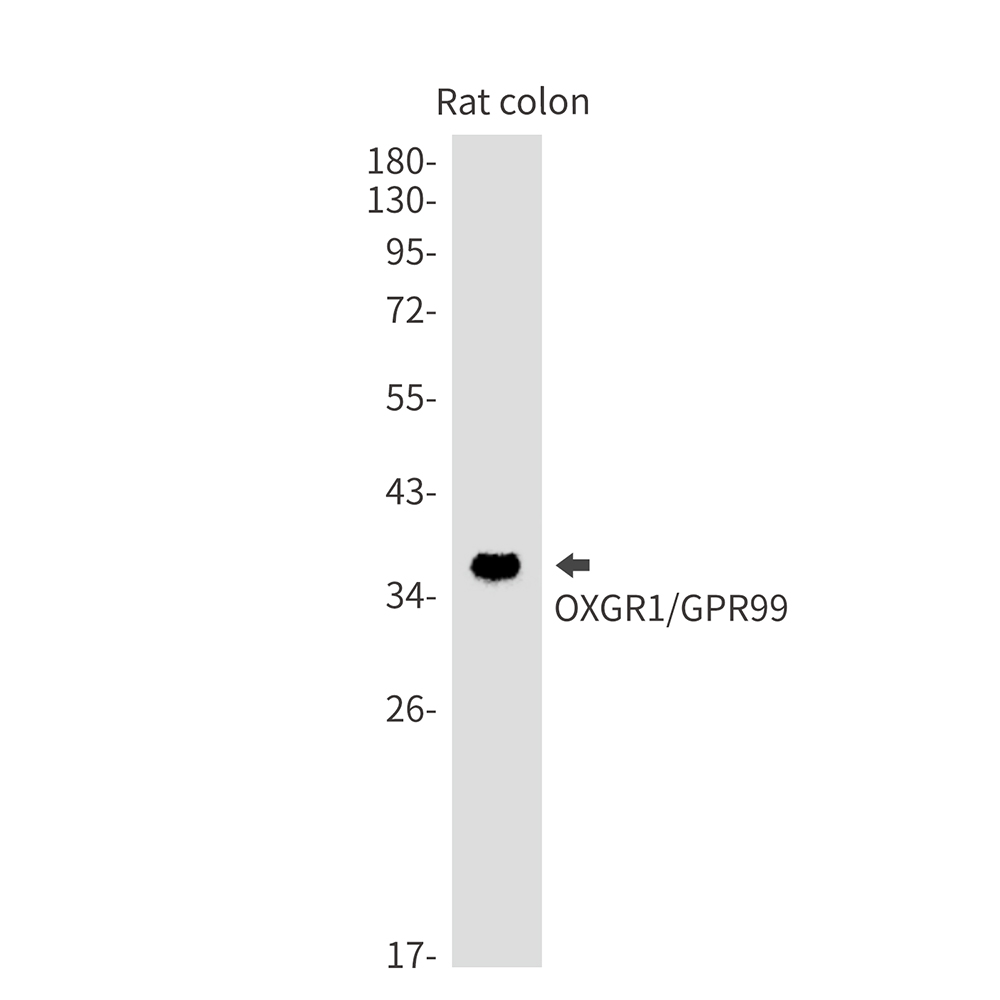 Rabbit monoclonal antibody