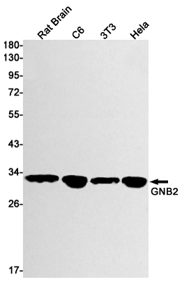 Rabbit monoclonal antibody