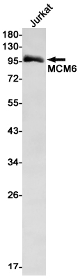 Rabbit monoclonal antibody
