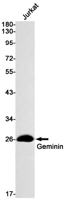 Rabbit monoclonal antibody