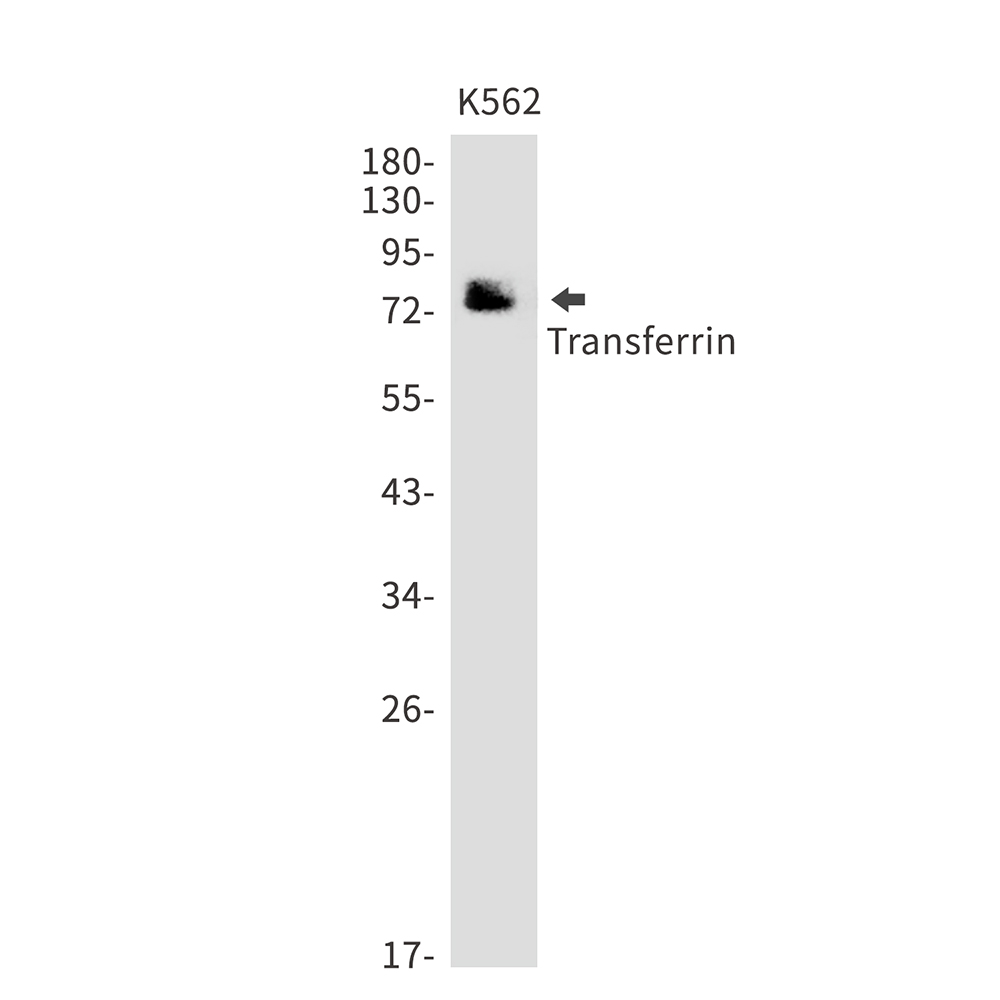 Rabbit monoclonal antibody