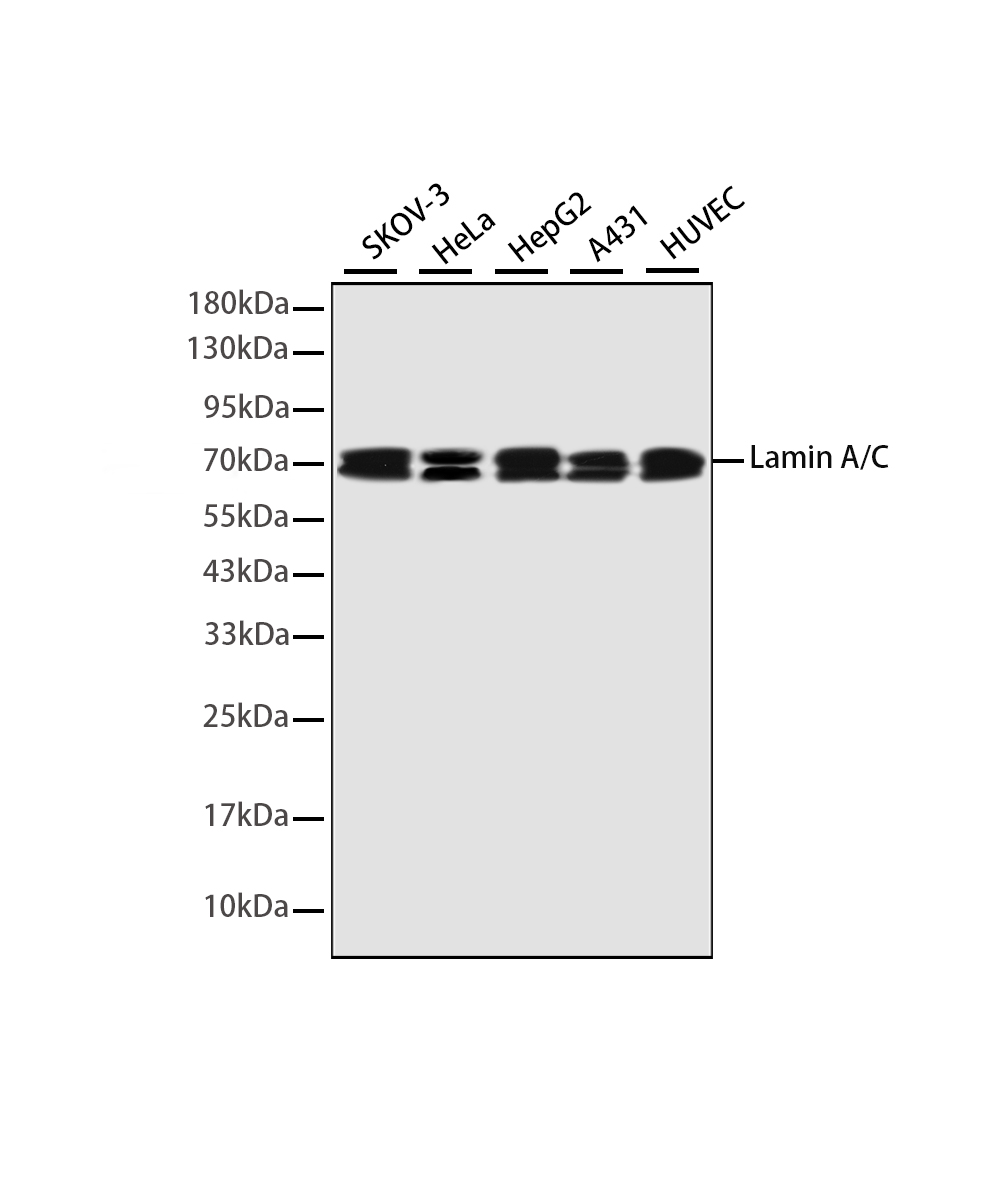 Rabbit monoclonal antibody