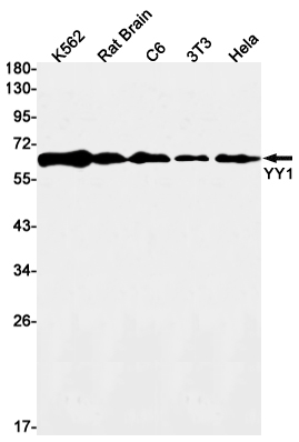 Rabbit monoclonal antibody